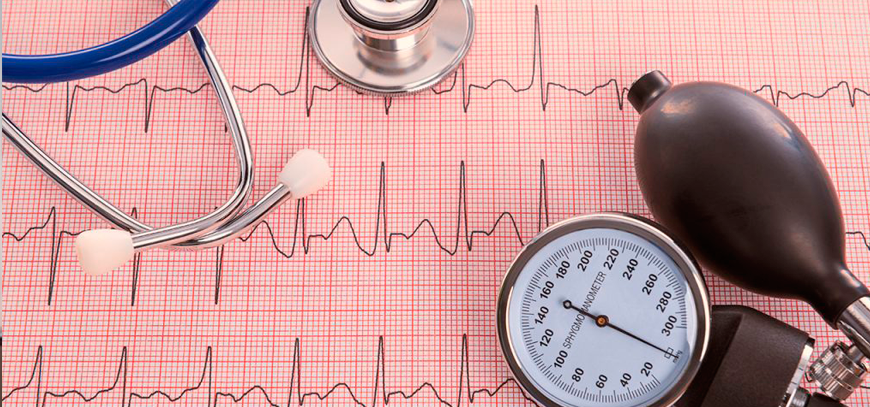 Eletrocardiograma